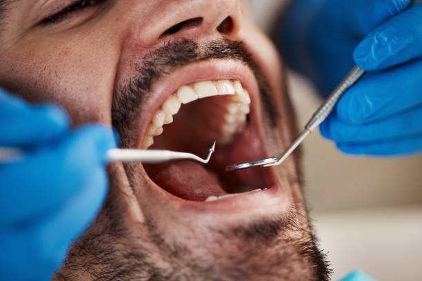 Best Emergency Treatment for Oral Infections in Aurora, MN